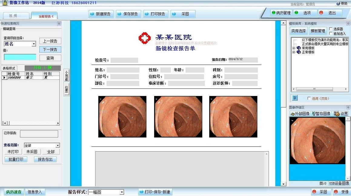 肠镜影像工作站